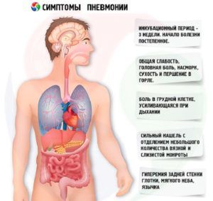 Симптомы пневмонии 