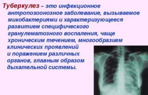 Туберкулез является одной из заболеваний которые лечит фтизиатр