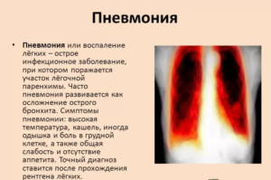 Гербион с первоцветом принимают при пневмонии 