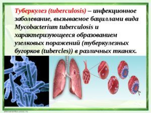 Массаж запрещен при туберкулезе