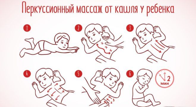 Схема перкуссионного массажа