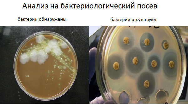 Бактериальный посев