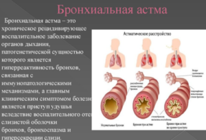 Аскорил применяют при бронхиальной астме