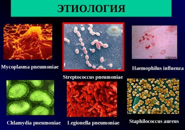 Этиология пневмонии грибковой природы