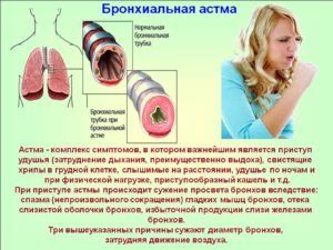 Факторы, вызывающие бронхиальный кашель