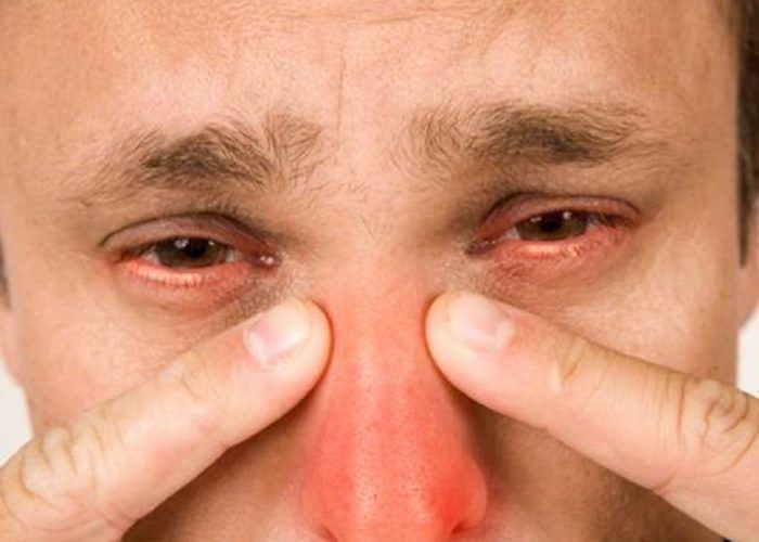 Гнойные воспалительные процессы дыхательных путей или носа