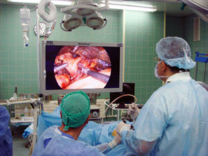 Хирургическое лечение при бронхоэктазии