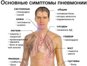 Симптомы пневмонии грибкового типа