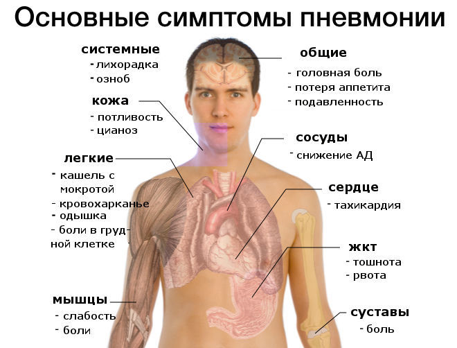 Симптомы внутрибольничной пневмонии
