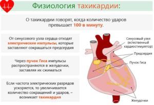Тахикардия является симптомом сердечного кашля