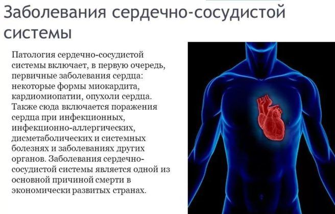 Заболевания сердца