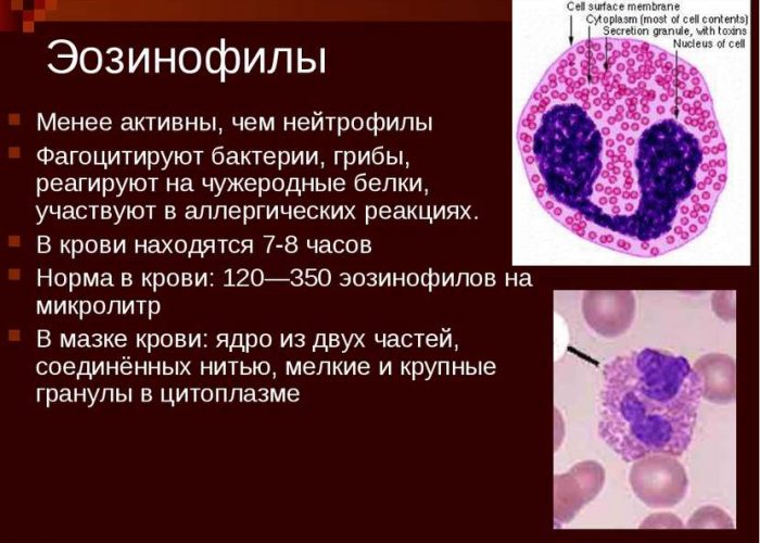 Высокой концентрации эозинофилов в крови