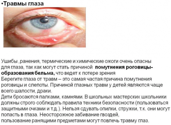 Причины возникновения травм глаза