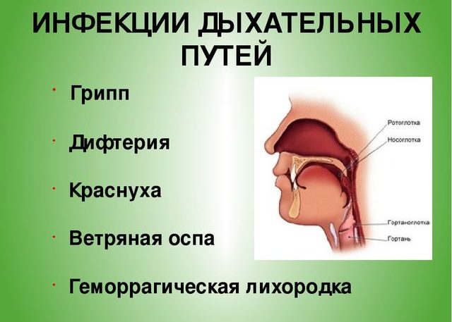 Вирусная инфекция дыхательных путей